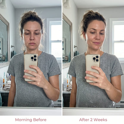 Novrik™ Facial Massager — De-Puff, Sculpt & Relax in 5 Minutes